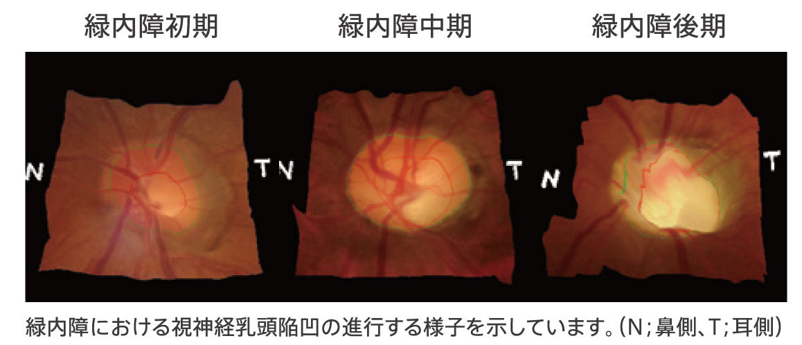 西原眼科　結膜炎　緑内障　白内障　アレルギー性結膜炎・花粉症　眼精疲労・ドライアイ・スマホ老眼